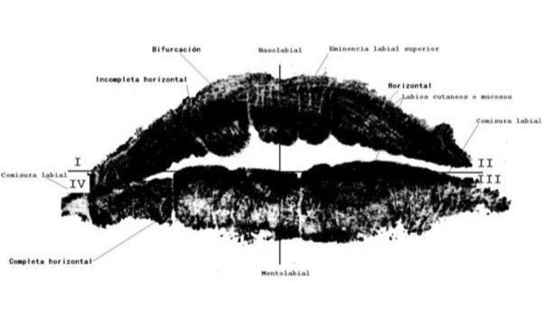 Queiloscopia aplicada a la identificación forense mediante huellas labiales